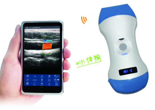 Introduction of Wireless Ultrasound