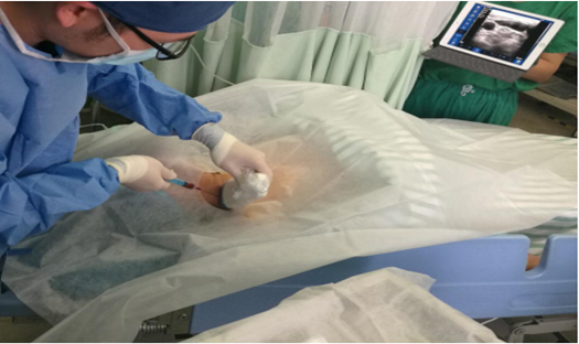 Wireless Palm Ultrasound Used in Anesthesiology