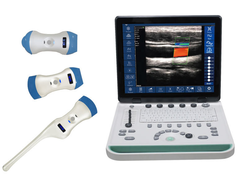 C5W Color Doppler Ultrasound Scanner