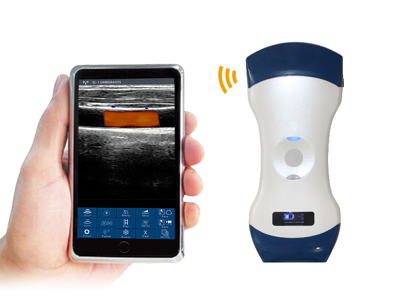 5CL 2in1 palm doppler ultrasound