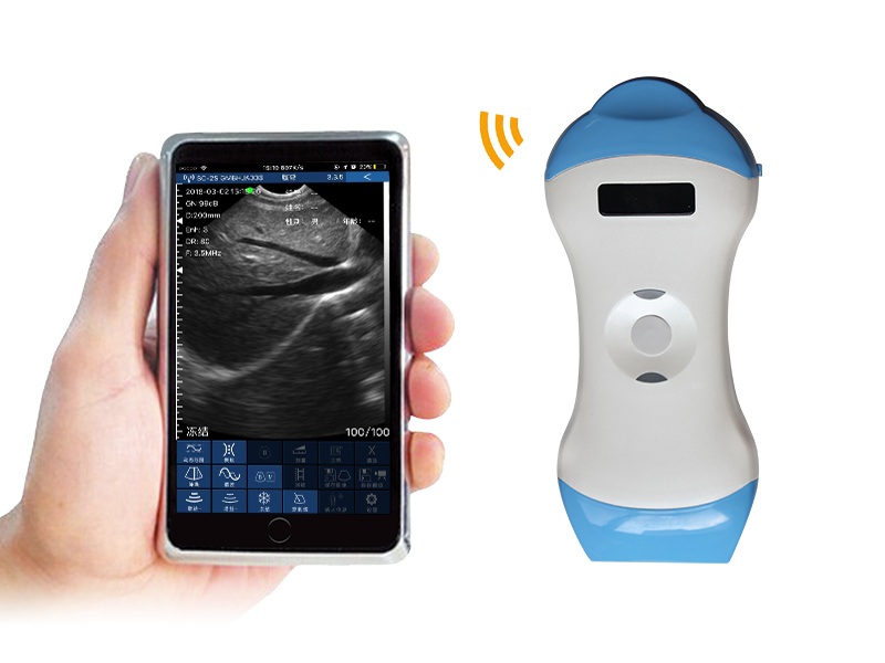 5ML 2in1 palm doppler ultrasound