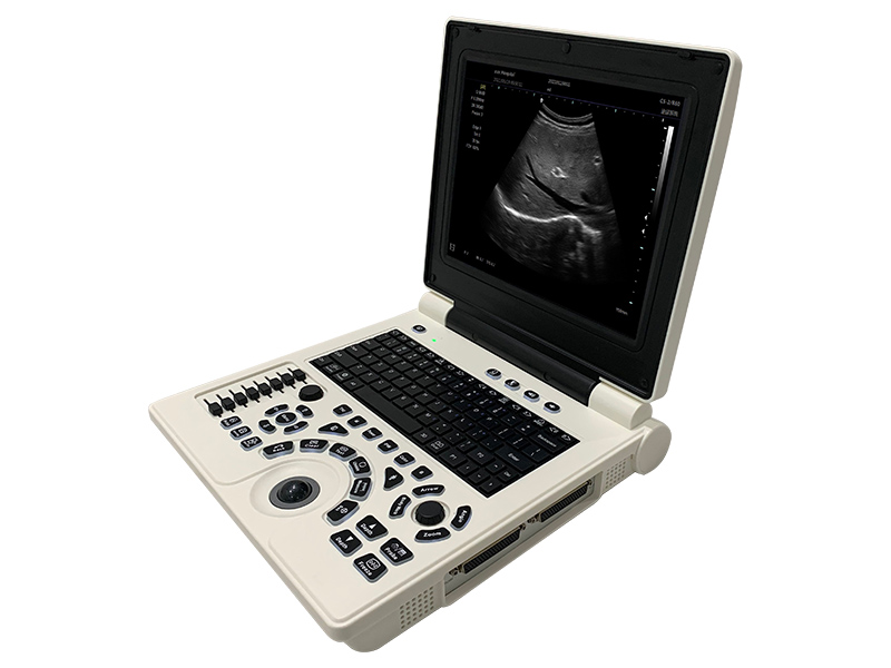 SS-9B Laptop Ultrasound Scanner