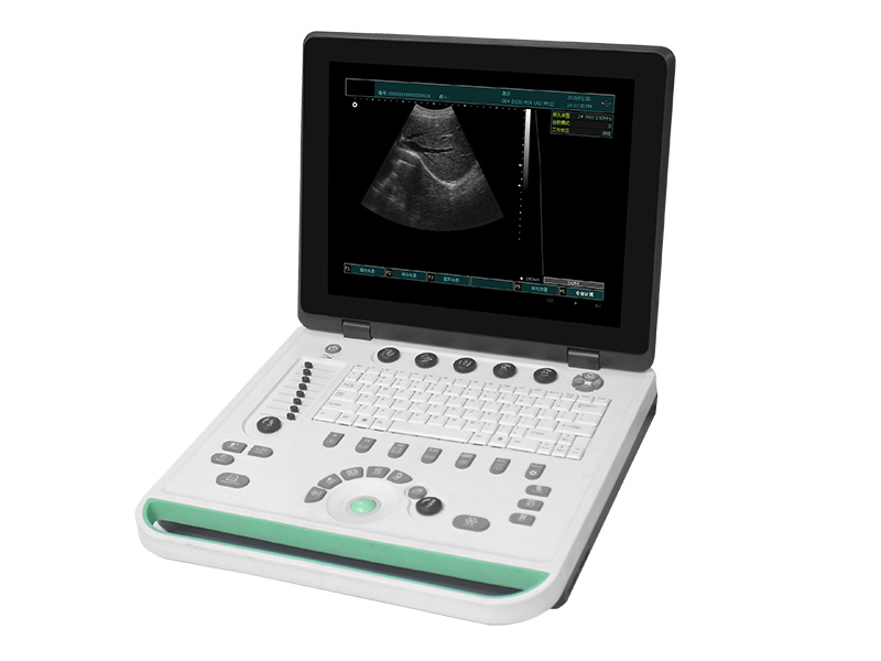 SS-9 PC Based Laptop Ultrasound B Scanner