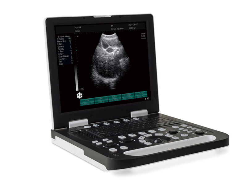 SS-10 Full Digital Laptop Ultrasound Scanner