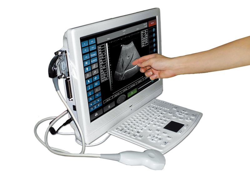 UTouch-8 Touch Screen LCD Ultrasound Scanner(ultrasoniblack whitescanner)