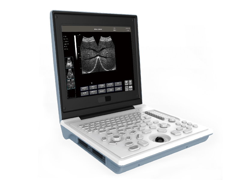 SS-6B Laptop All-Digital Ultrasound Diagnostic System