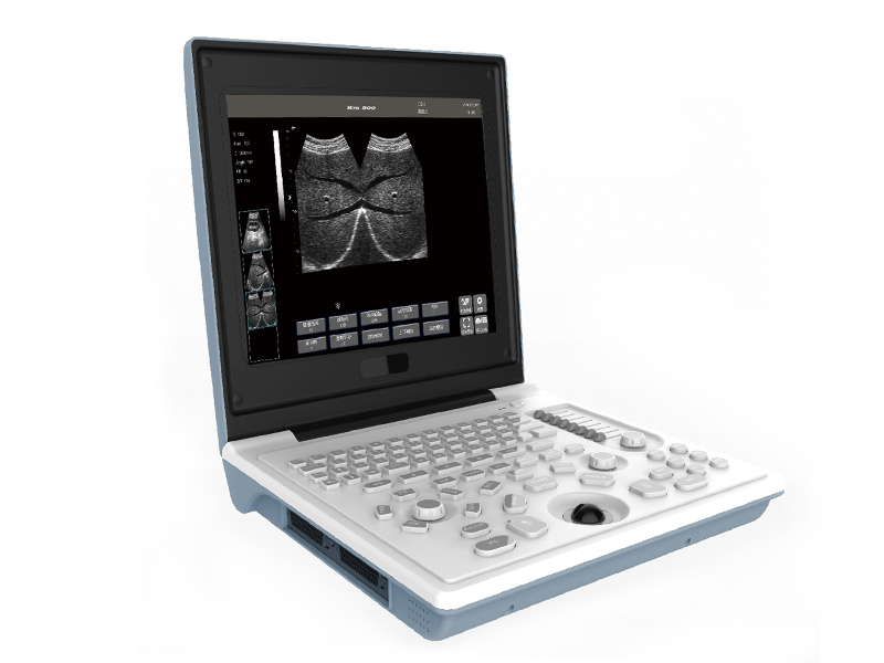 SS-6B 笔记本全数字超声诊断仪
