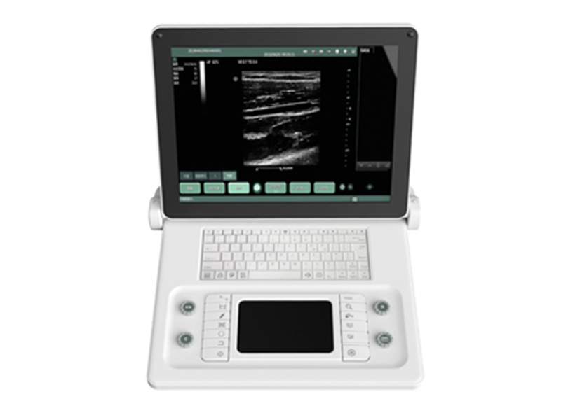 SS-8B B/W Laptop ultrasound system