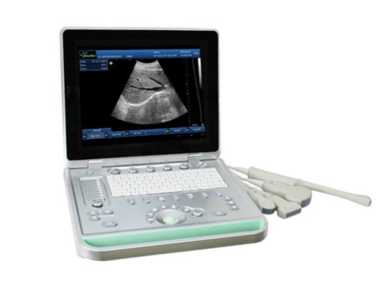 V9(SS-9) Laptop Ultrasound B scanner(ultrasoundultrasoniblack whitescanner)