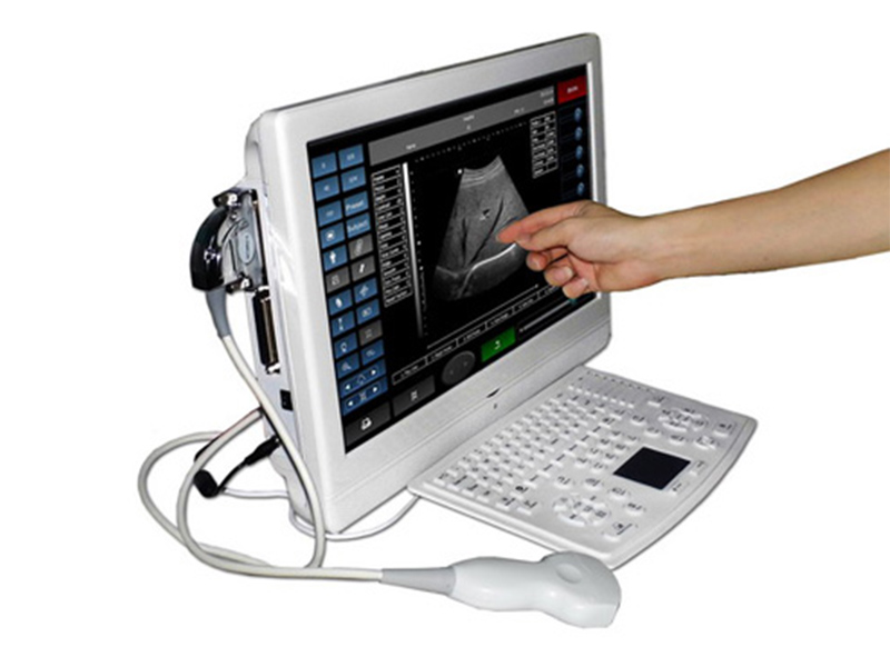 V8(UTouch-8) LCD Ultrasound Scanner(ultrasoniblack whitescanner)