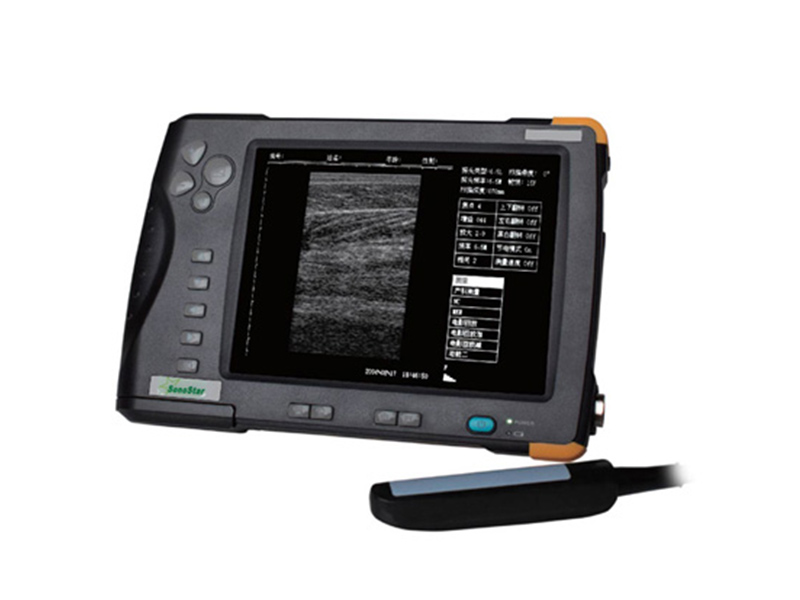 V5 Palm Ultrasound Scanner(ultrasonicblack whiteImaging System