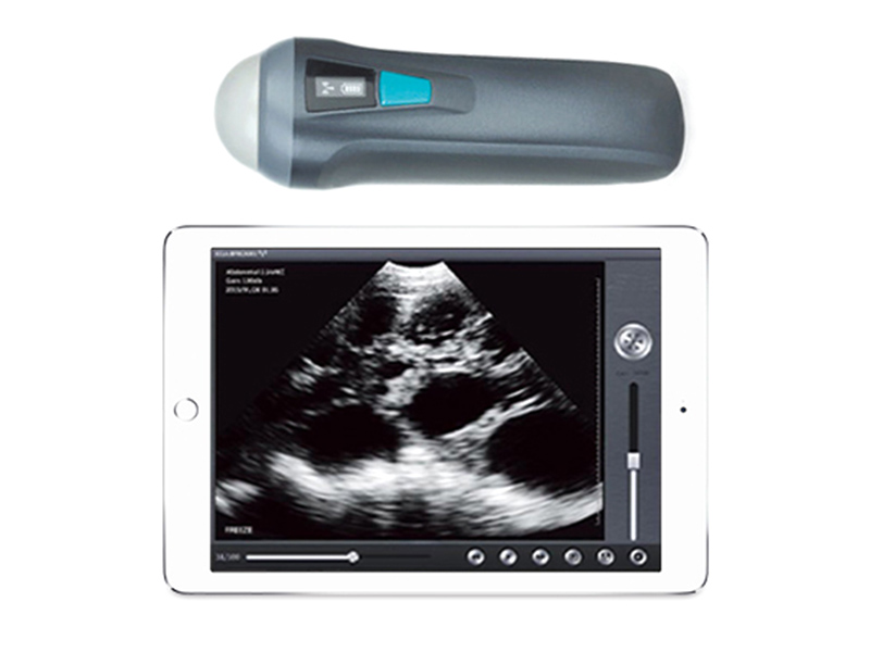 UProbe-1 Wireless Probe Ultrasound Scanner