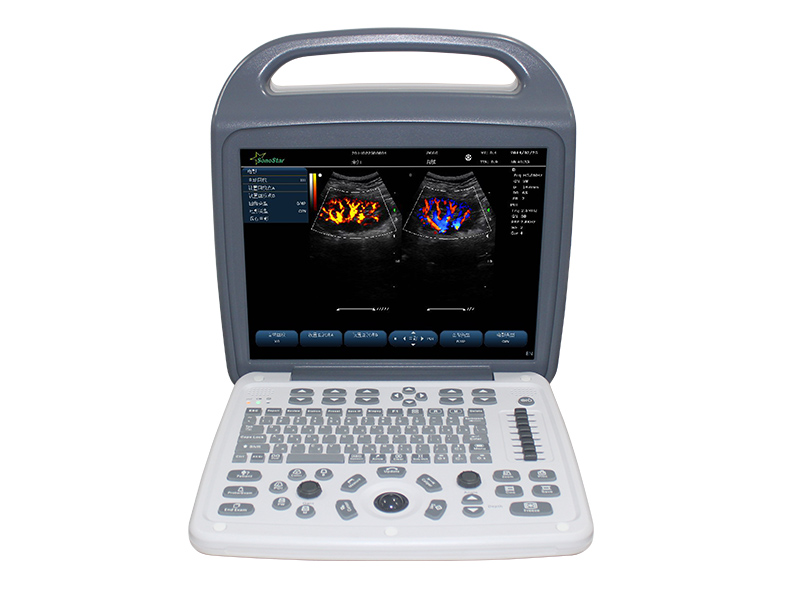 C10M Color Doppler Ultrasound Scanner