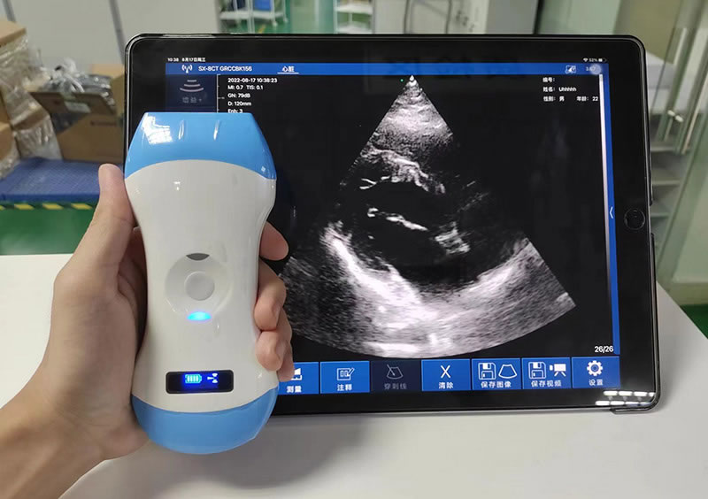 5CPL 3in1 palm doppler ultrasound