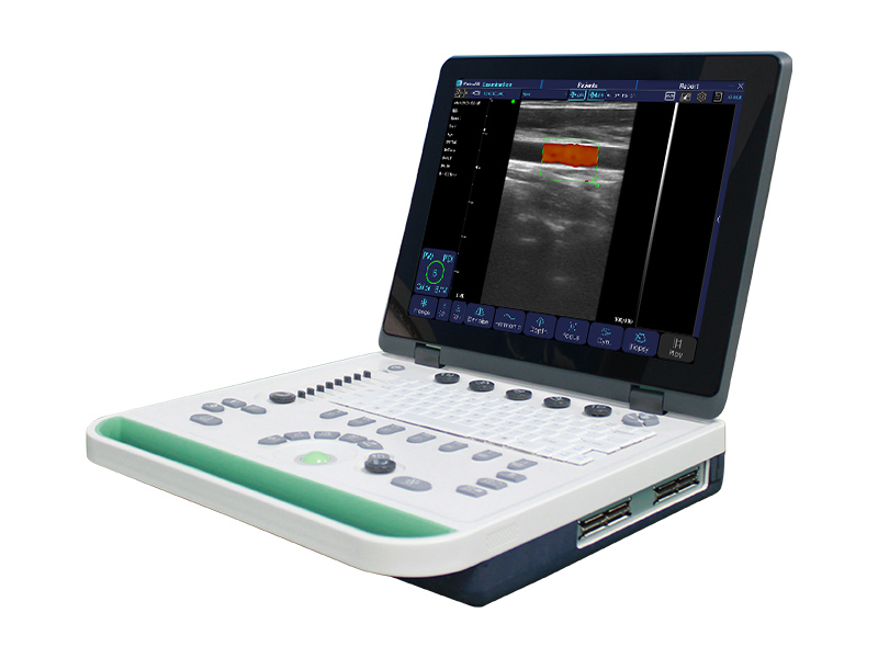 C5Pro Laptop Color Doppler