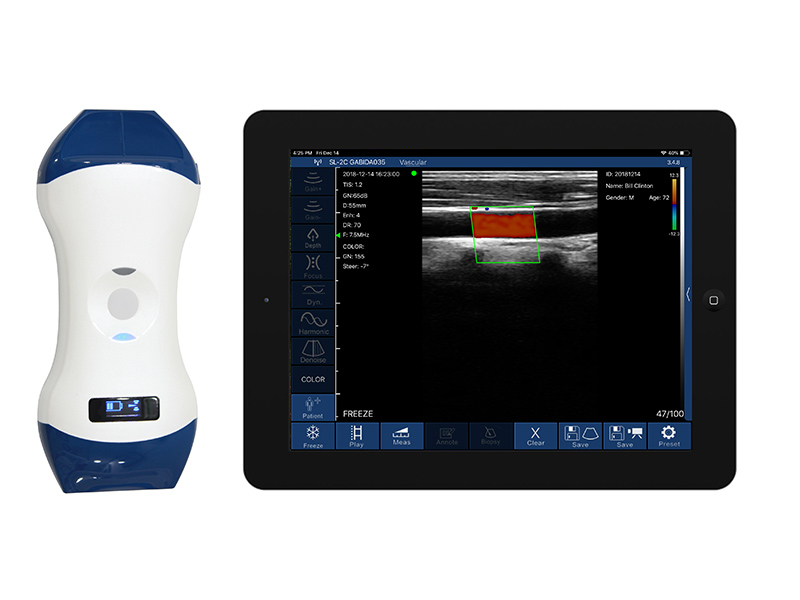 5LP 2in1 palm doppler ultrasound