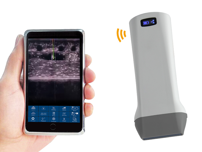 6X Accurate Puncture Linear Handheld Color Wireless Probe Type Ultrasound Scanner