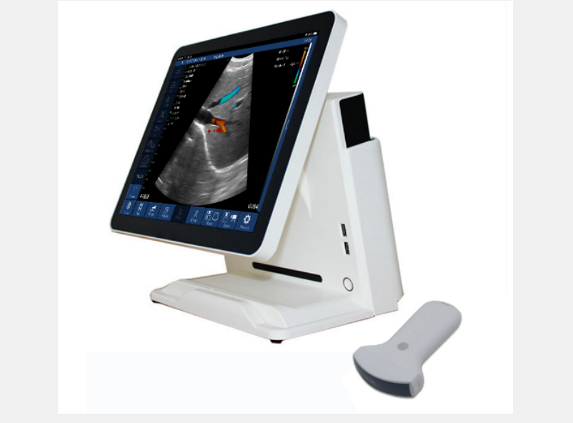 Touch Screen Windows Host for Palm Ultrasound Scanner