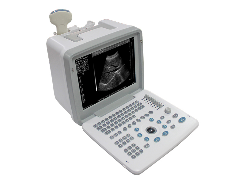 SS-6 Portable Ultrasound Scanner