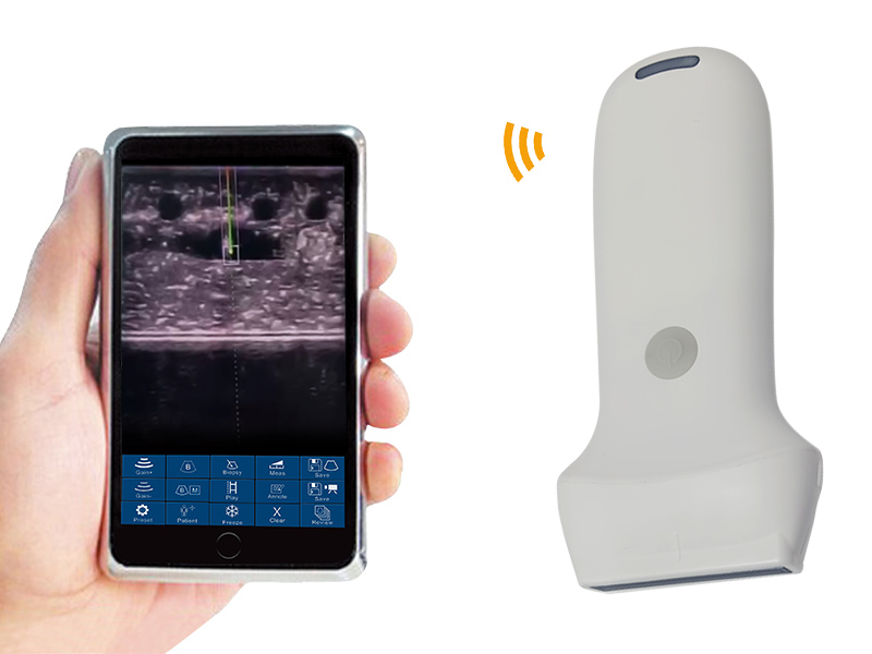 8X Accurate Puncture Linear Handheld Color Wireless Probe Type Ultrasound Scanner