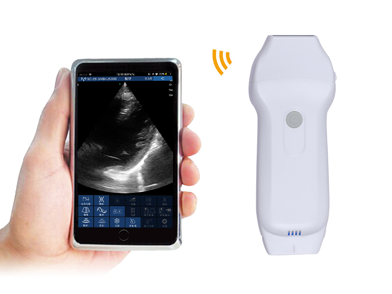 4LPA 2in1 palm doppler ultrasound