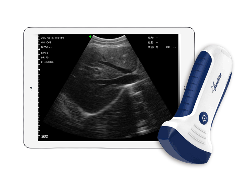 7C convex palm doppler ultraso