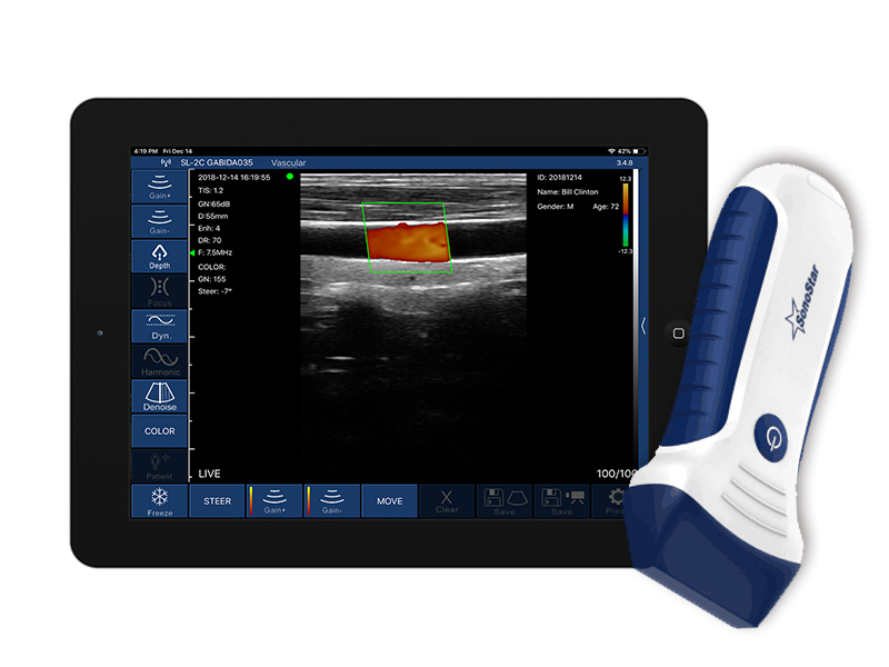 7L linear palm doppler ultraso