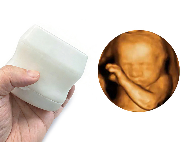 3D Scanning Stereo Imaging Handheld Ultrasound