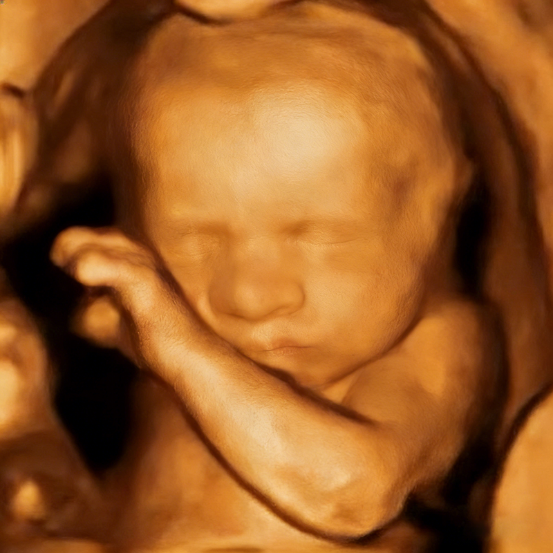 2026013019452053.png 将图片变清晰 (2).png