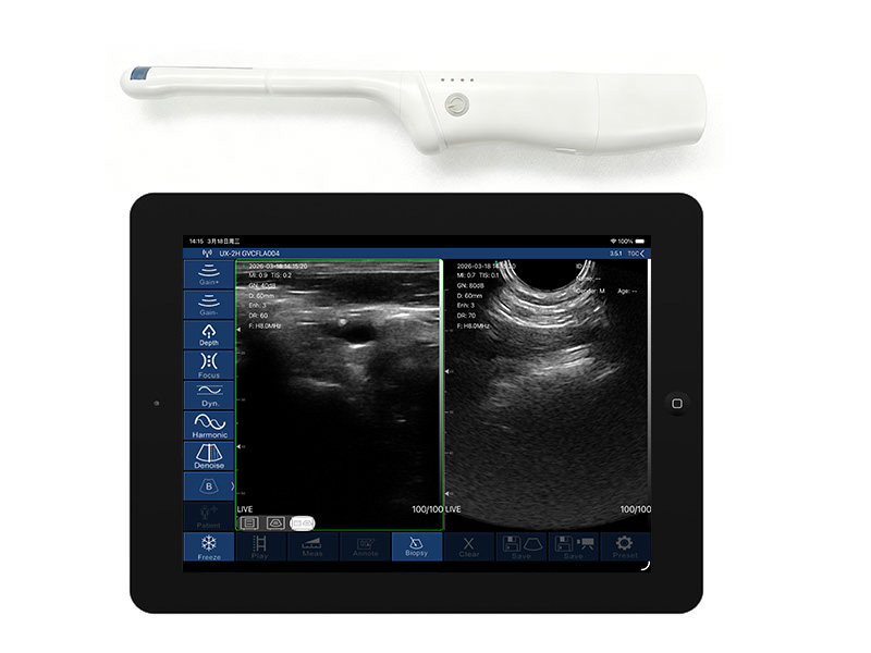 8CR直肠T型双平面无线探头式掌上彩超