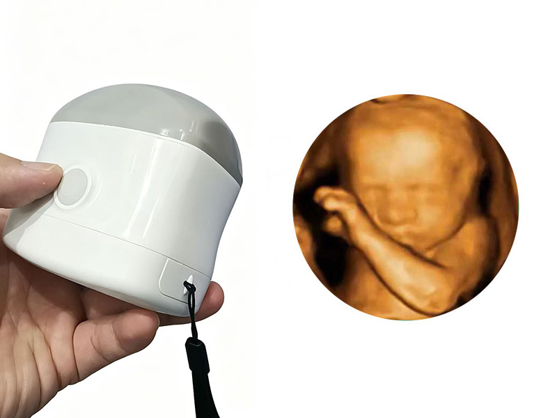 4D Scanning Stereo Imaging Handheld Ultrasound