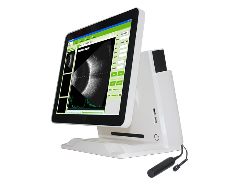 Clinical Procurement Guide for Sonostar Portable Ultrasound Diagnostic Devices Clinical Procurement Guide for Sonostar Portable Ultrasound Diagnostic Devices