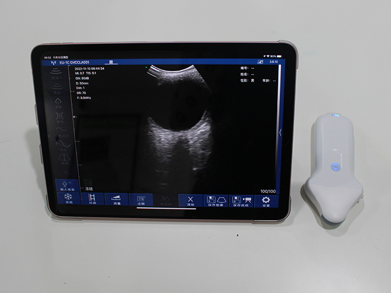 Clinical Procurement Guide for Sonostar Portable Ultrasound Diagnostic Devices Clinical Procurement Guide for Sonostar Portable Ultrasound Diagnostic Devices