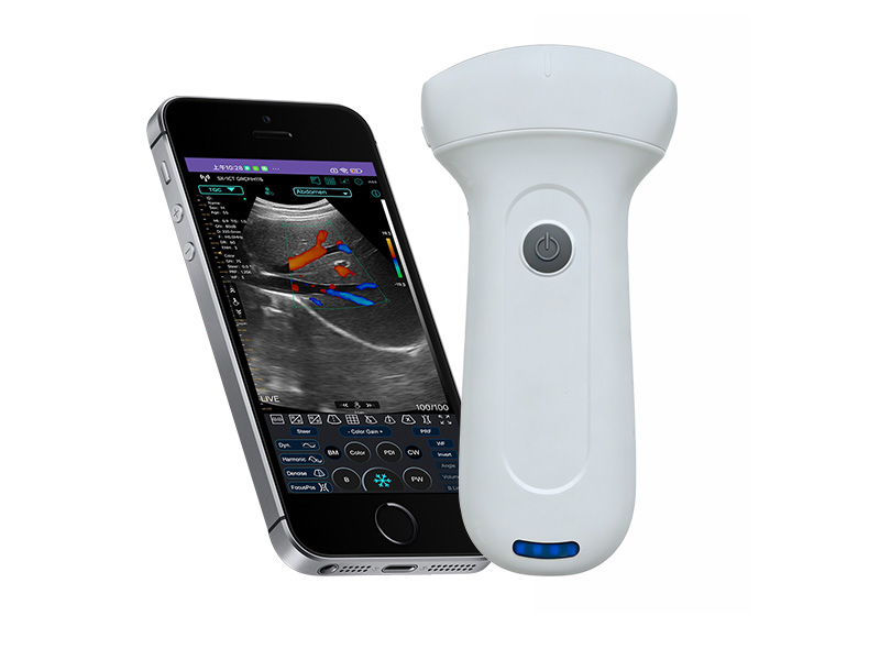 Clinical Procurement Guide for Sonostar Portable Ultrasound Diagnostic Devices Clinical Procurement Guide for Sonostar Portable Ultrasound Diagnostic Devices
