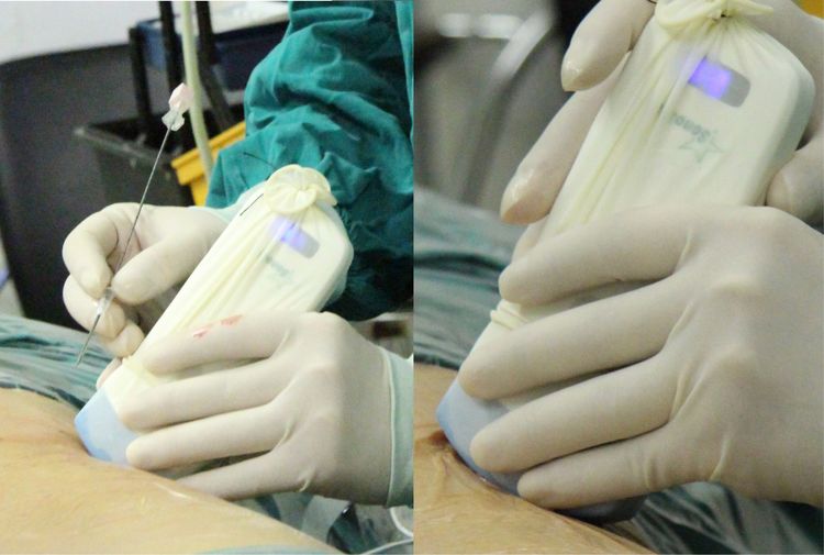 Application of Portable Imaging Technology by Handheld Ultrasound Manufacturers in Primary Care and Application of Portable Imaging Technology by Handheld Ultrasound Manufacturers in Primary Care and